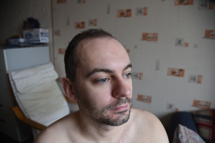Image-normal