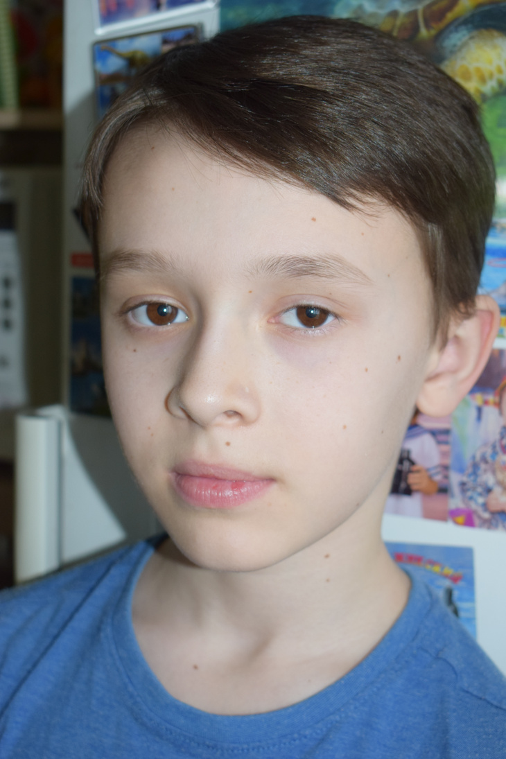 Image-normal