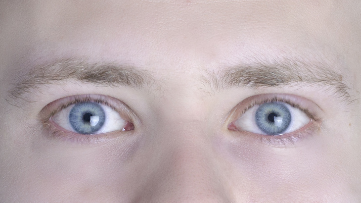Image-normal